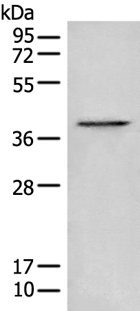 BLVRA Antibody