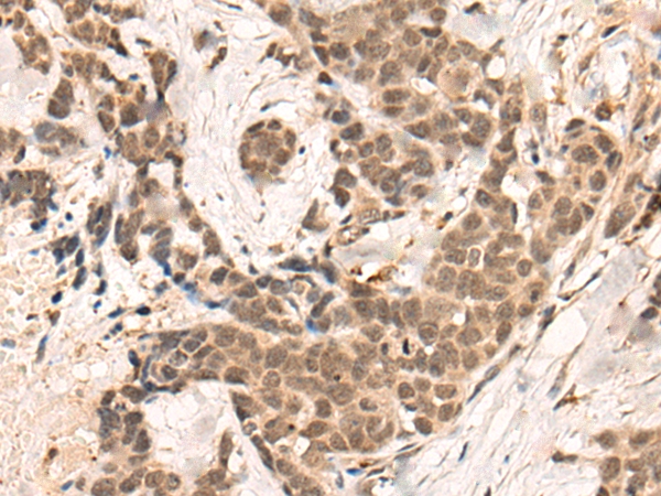 BRD8 Antibody
