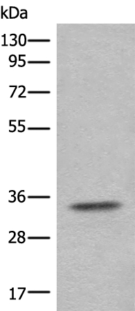 C21orf59 Antibody