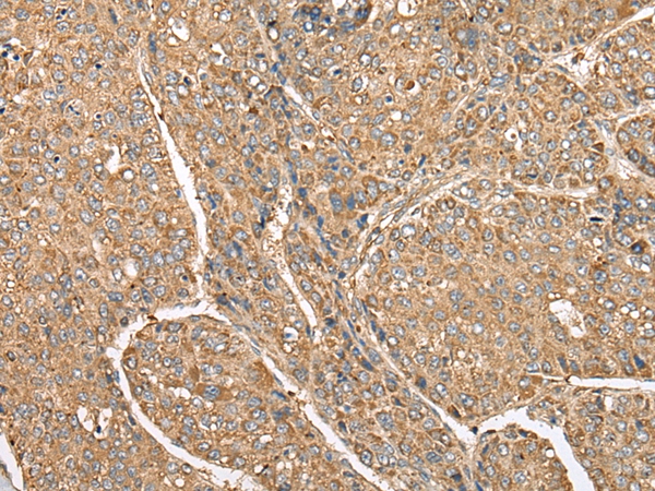 C5AR1 Antibody