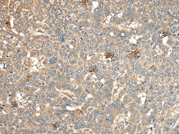 CA11 Antibody