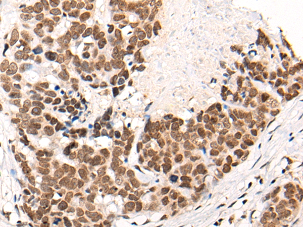 CACNA1H Antibody