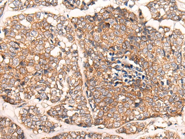 CACNA2D2 Antibody