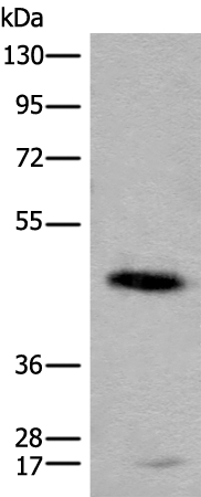 CADM2 Antibody