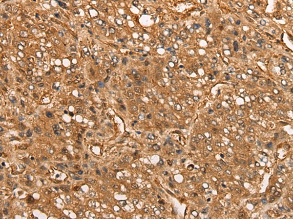 CALML6 Antibody