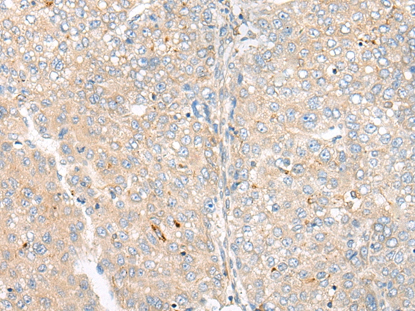 CAMK2A Antibody