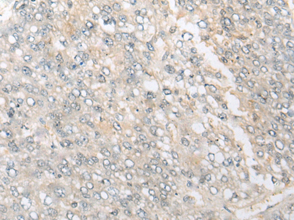 CAMSAP1 Antibody