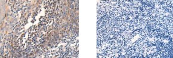 CAPN14 Antibody