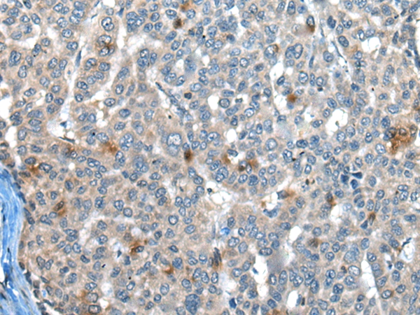 CAPN3 Antibody