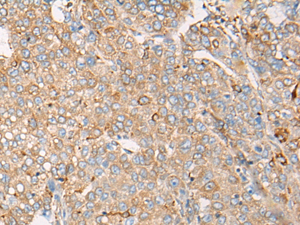 CAPN9 Antibody