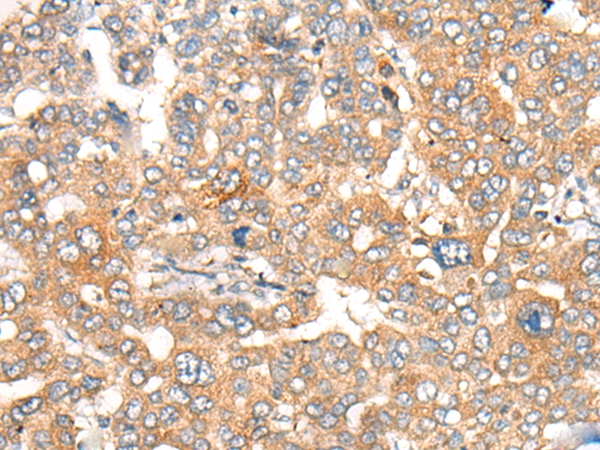CASP4 Antibody