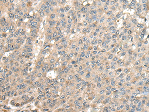 CASQ1 Antibody