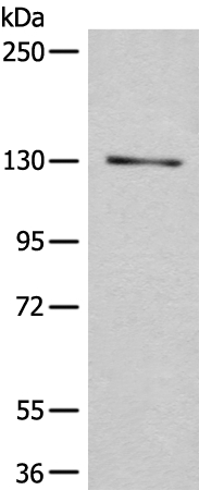 CASR Antibody