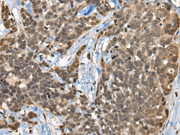CBFA2T3 Antibody
