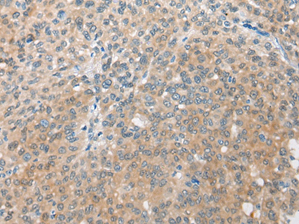 CBR3 Antibody