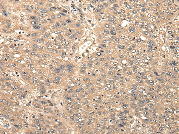 CCNYL1 Antibody