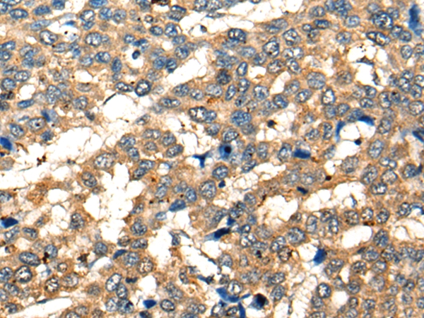 CD28 Antibody