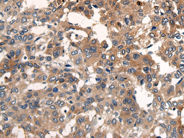 CDH17 Antibody