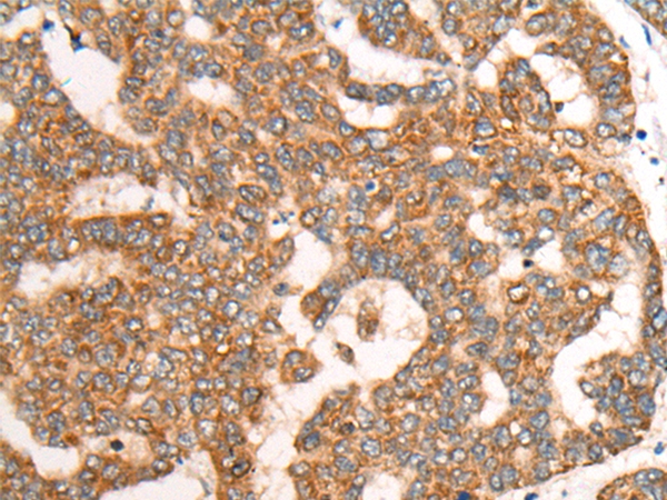 CDON Antibody