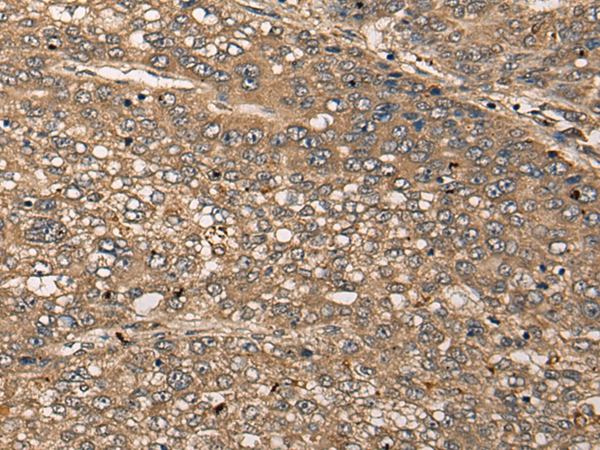 CDRT15L2 Antibody