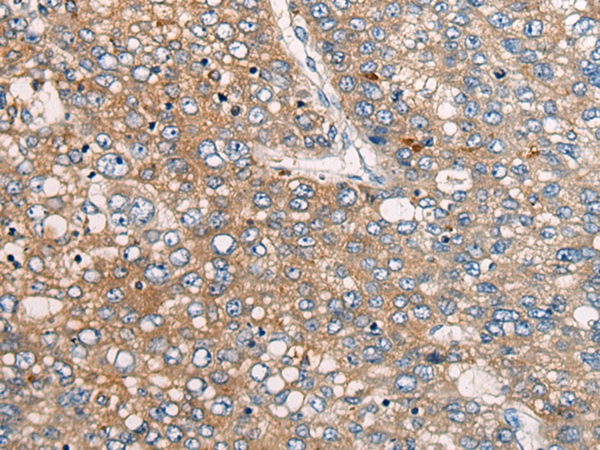 CDV3 Antibody