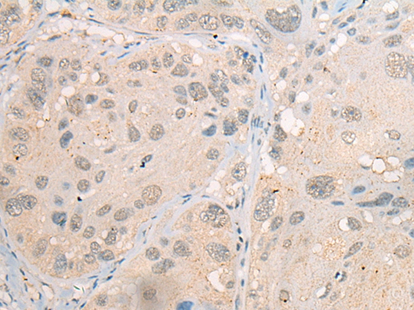 CDYL2 Antibody