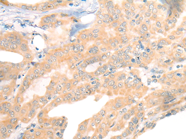 CEP290 Antibody