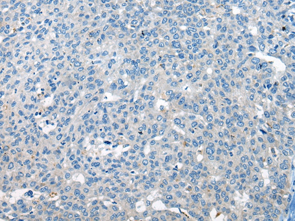 CHM Antibody