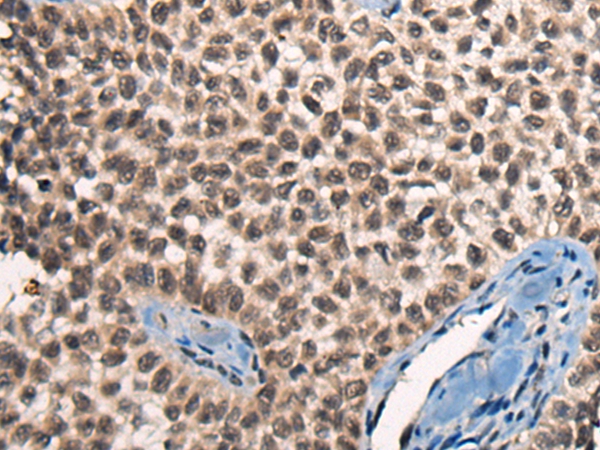 CITED2 Antibody