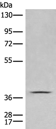 CLN5 Antibody