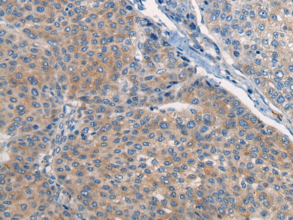 CNTN5 Antibody
