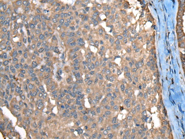 CTNNAL1 Antibody