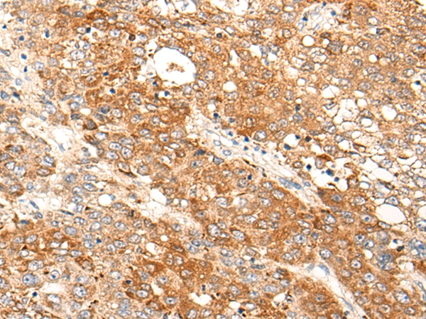 CXorf36 Antibody