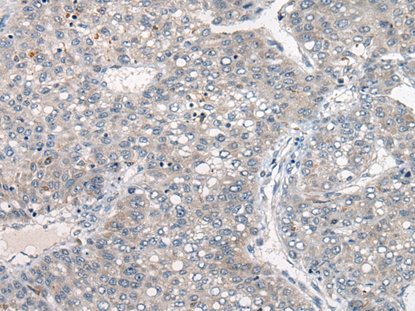 DGKI Antibody
