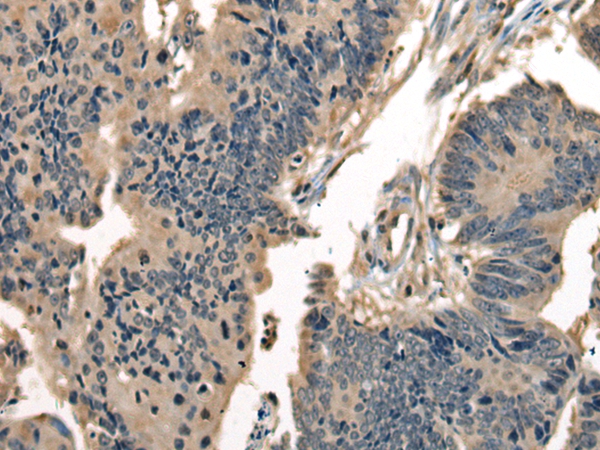 DNAJC2 Antibody