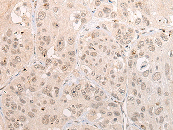 DPF3 Antibody