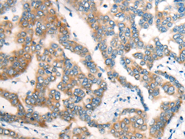 DTL Antibody
