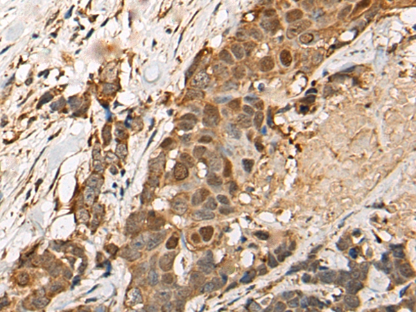 HEATR9 Antibody