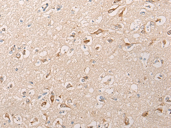 HTRA1 Antibody