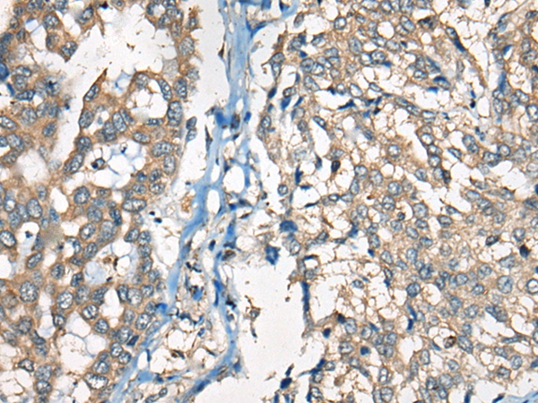Kappa Light chain Antibody