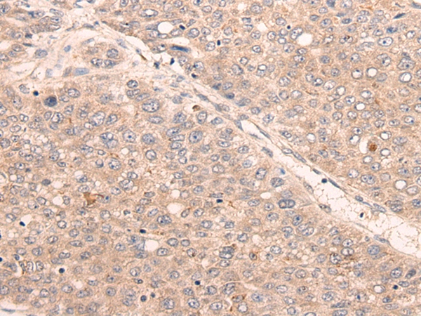 KDF1 Antibody