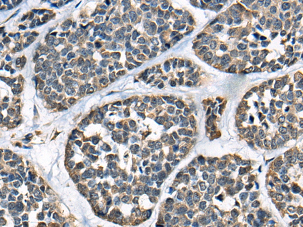 KLHL12 Antibody