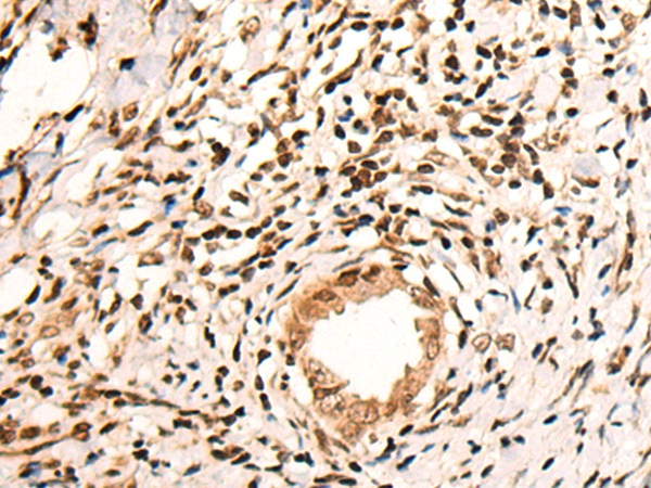 KMT2C Antibody
