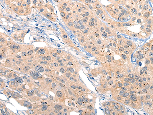 MIIP Antibody