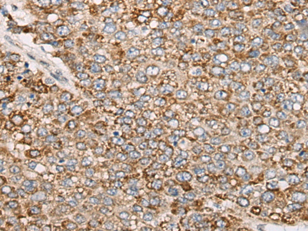 PCDHGB5 Antibody