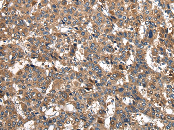 PIWIL2 Antibody