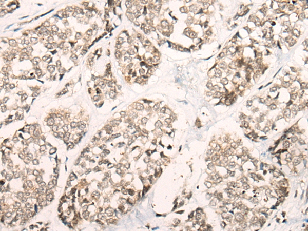 POLA1 Antibody
