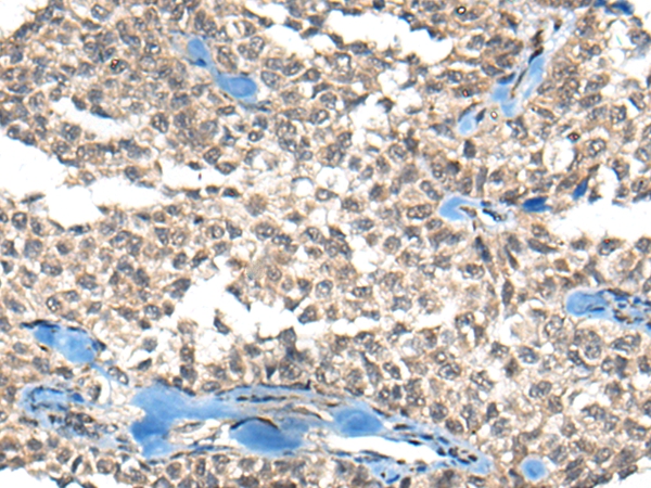 REST Antibody