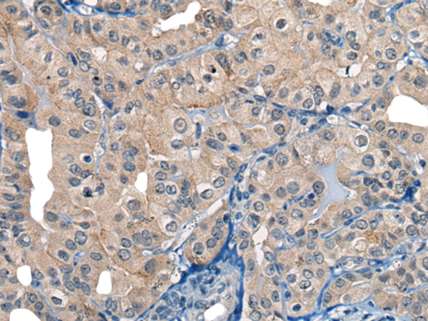 RFWD2 Antibody