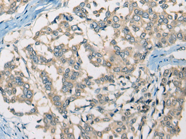 SLC5A3 Antibody
